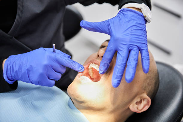 Best Broken or Cracked Tooth Emergency Dentist in Basin, WY